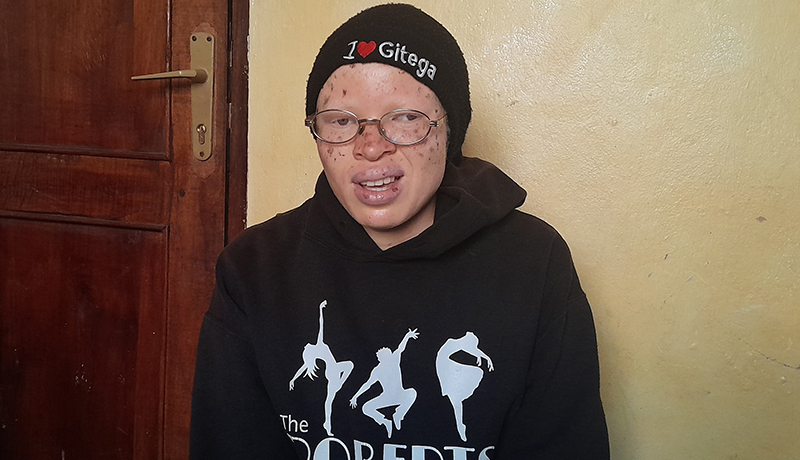 Discrimination et défis sanitaires : les personnes albinos de Kayanza réclament protection et soutien