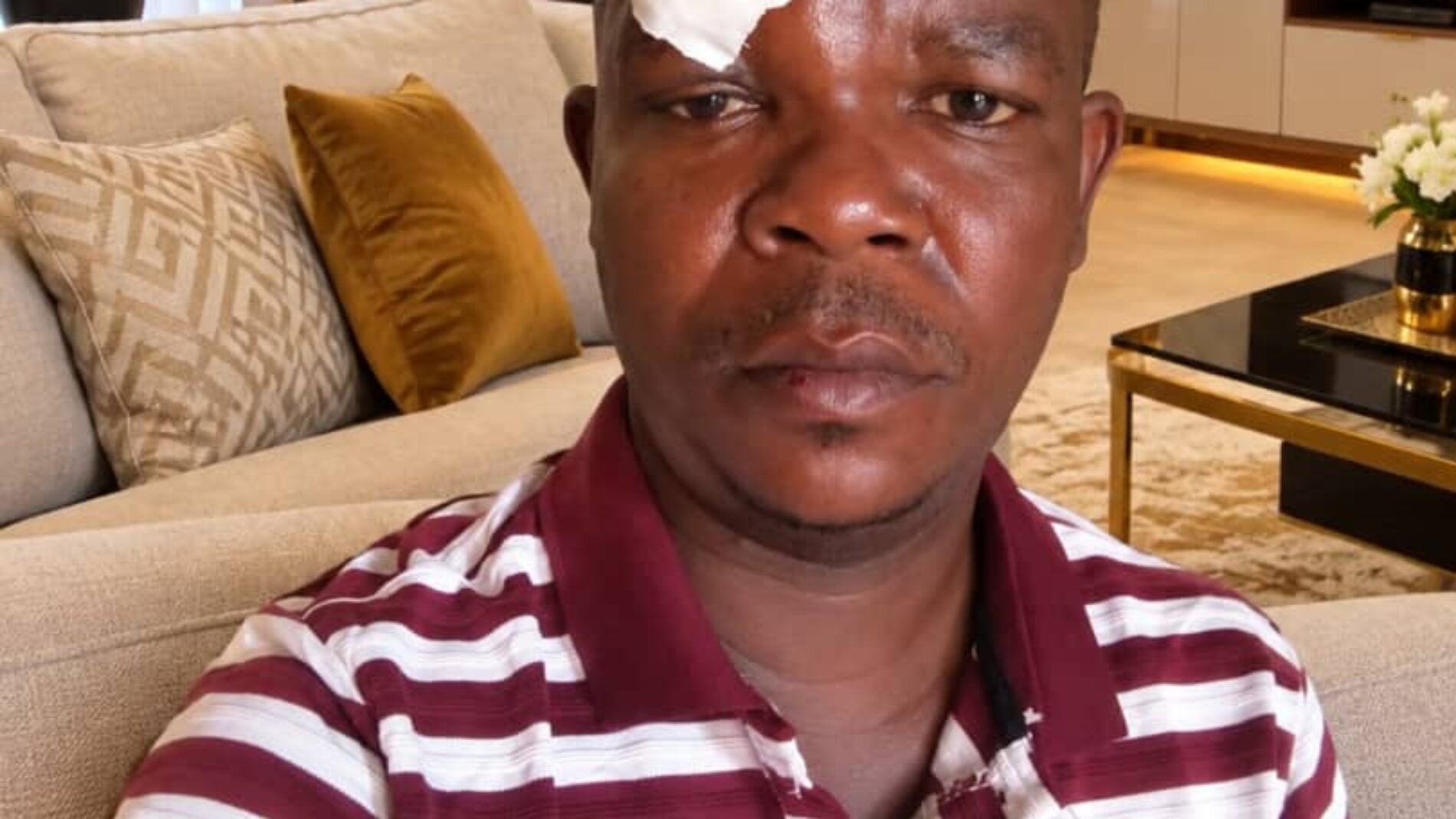 Journaliste Kenny Claude Nduwimana violemment agressé à Bujumbura