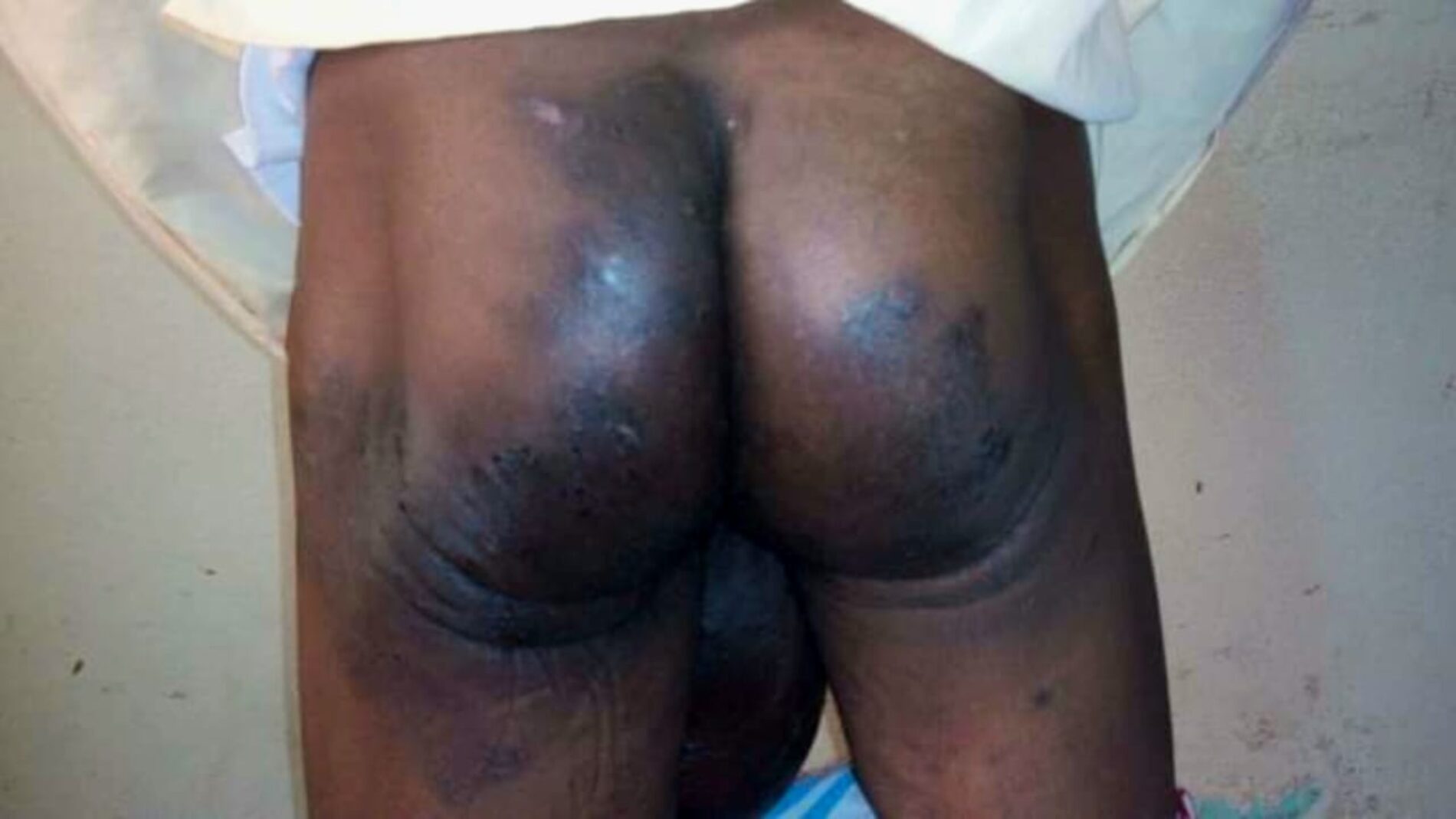Rapport de la Ligue Iteka : Détérioration des Droits Humains au Burundi